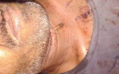 رصاصة راجع تخترق يد وصدر مواطن نائم على سطح منزله  في لودر