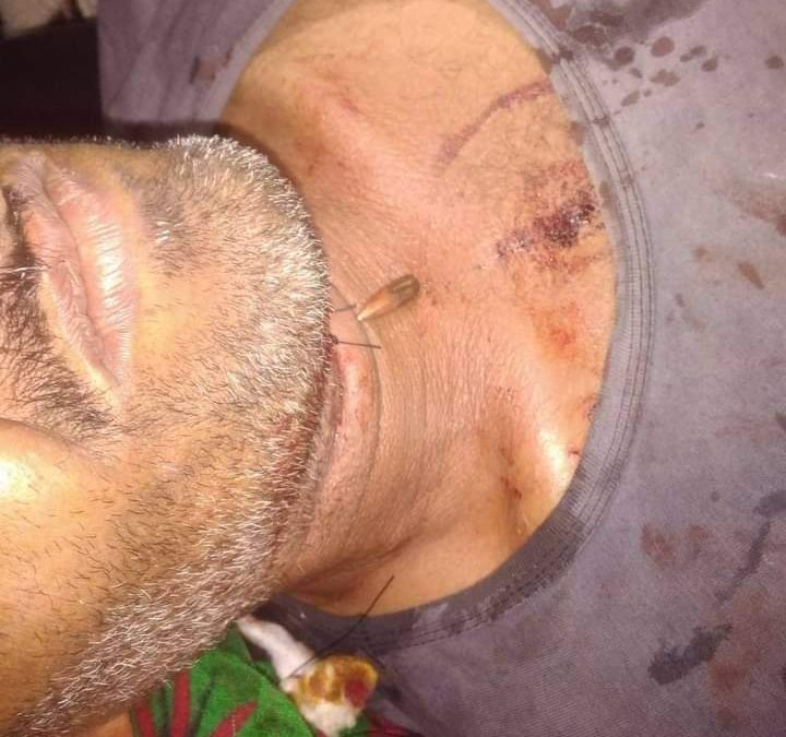 رصاصة راجع تخترق يد وصدر مواطن نائم على سطح منزله  في لودر