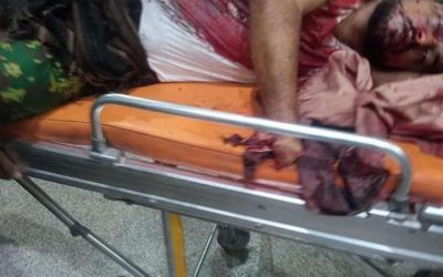 هجوم ارهابي يستهدف المصلين في مسجد اليرموك بصبر لحج