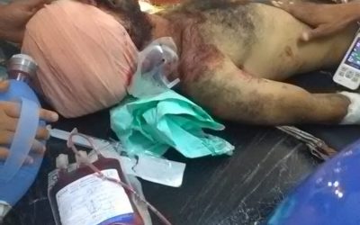 مليشيات الحوثي تستهدف مواقع القوات الجنوبية والمشتركة شمال الضالع وسقوط شهيد وجريح