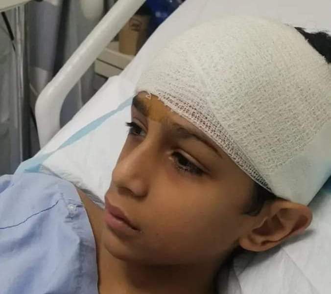 بسبب “حركات المصارعين”.. طالب يكسر جمجمة زميله في مدرسة بالسعودية