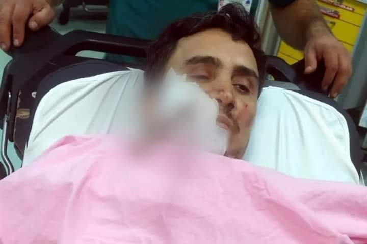 بعد سقوط مروع.. عامل ينجو من الموت بأعجوبة