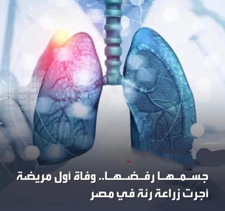 وفاة المريضة التي أجريت لها  أول زراعة رئة في مصر