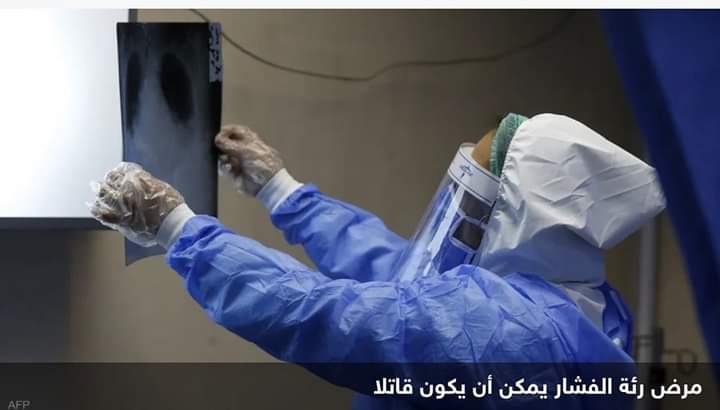 بعد سنة ونصف من “إدمان الفيب”.. اكتشاف مرض مميت في رئة شابة