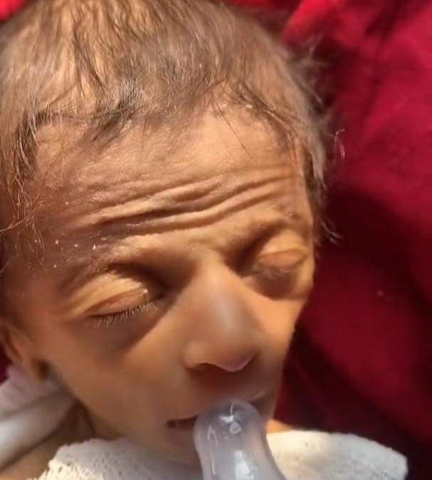 فيديو متداول لطفل حديث الولادة بوجه رجل عجوز يثير الجدل