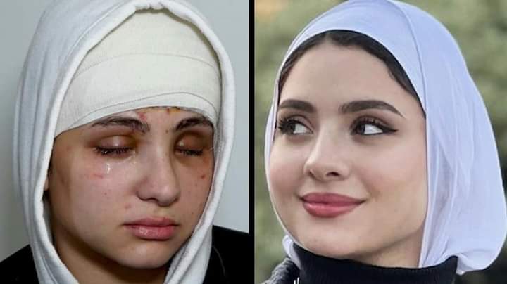 بعد أن أفدت خطيبها وتلقت الطلقات في أعينها بدلًا منه ثم تركها.. البلوغر المصرية سارةمحمد تعلن فقدان بصرها تمامًا