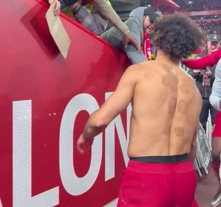 ظهور لافت لـ محمد صلاح بالحجامة على ظهره بعد نهاية مباراة أمس تثير التفاعل على الإنترنت