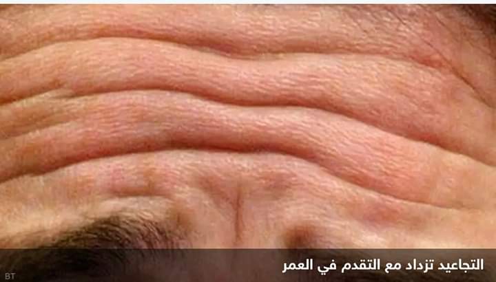منطقة في الجسم تشيخ مبكرا.. الطب يشرح السبب