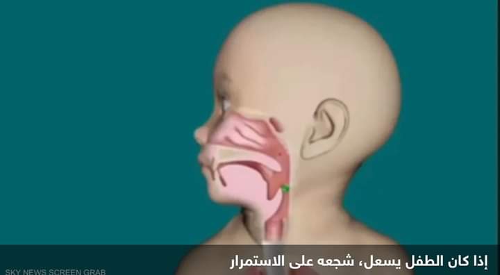 اختناق الطفل.. كيف تتجاوز الموقف الصعب؟