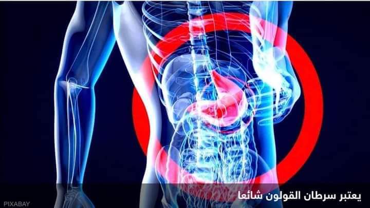 رياضة ونظام صحي.. مفارقة طبية قد يرتفع معها خطر السرطان