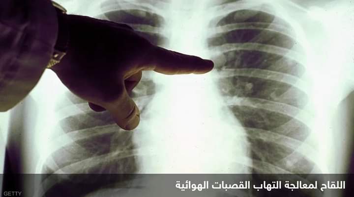 الولايات المتحدة تسمح بلقاح ثان ضد “التهاب القصيبات