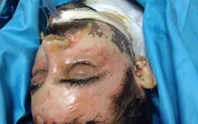 وفاة الشاب الذي أحرق نفسه في الشيخ عثمان