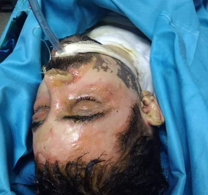 وفاة الشاب الذي أحرق نفسه في الشيخ عثمان