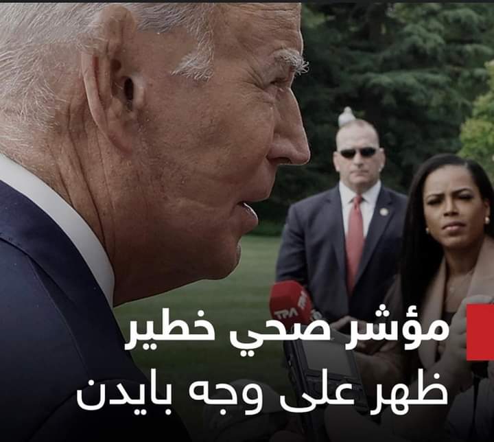 علامة على وجه بايدن تثير الجدل.. والبيت الأبيض يوضح