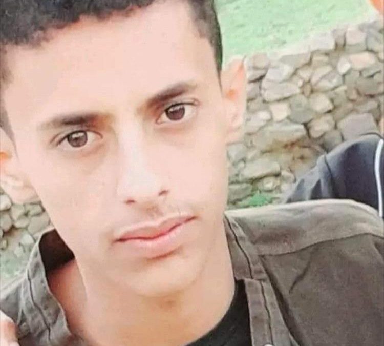 تصادم دراجتين ناريتين في رخمة يافع يودي بحياة شاب والآخر مغمى عليه-صور-