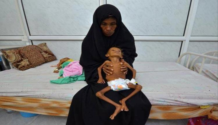 اسباب الإنهيار الإقتصادي وتردي الأوضاع المعيشية في الجنوب