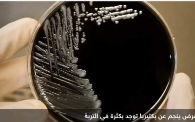 بولندا.. وفيات ومصابون ببكتيريا “تنتقل بالماء ومكيف الهواء”