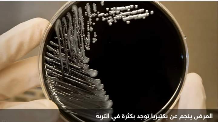 بولندا.. وفيات ومصابون ببكتيريا “تنتقل بالماء ومكيف الهواء”