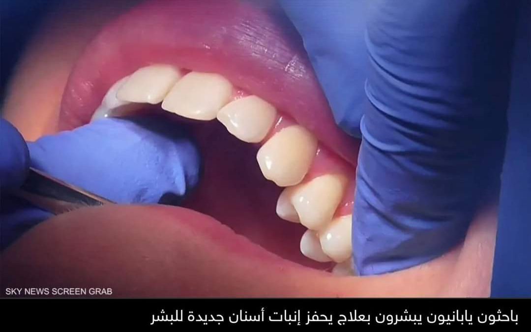 بعد اللبنية والدائمة.. دواء “يُنبت” جيلا ثالثا من الأسنان