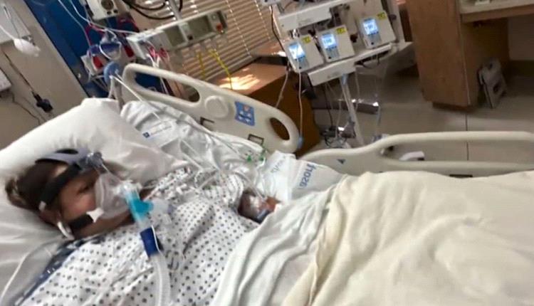 وجبة سمك تتسبب في بتر الأطراف الأربعة  لأمرأة أربعينية