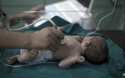 منظمة إسرائيلية غير حكومية تعلن وفاة رضيعين خدج في مشفى الشفاء