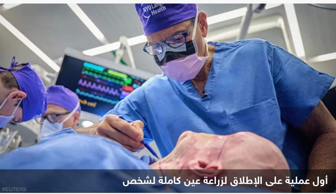 إنجاز طبي غير مسبوق.. تفاصيل أول عملية زراعة عين كاملة