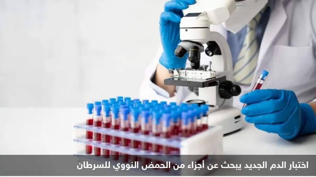 أمل جديد لمرضى سرطان الجلد.. اختبار دم يتيح محاصرة المرض