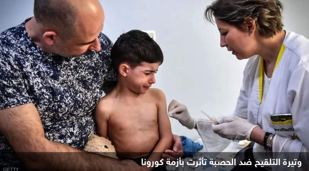 طوارئ في بريطانيا.. تحذير رسمي من تفشي الحصبة “بمعدل خطير
