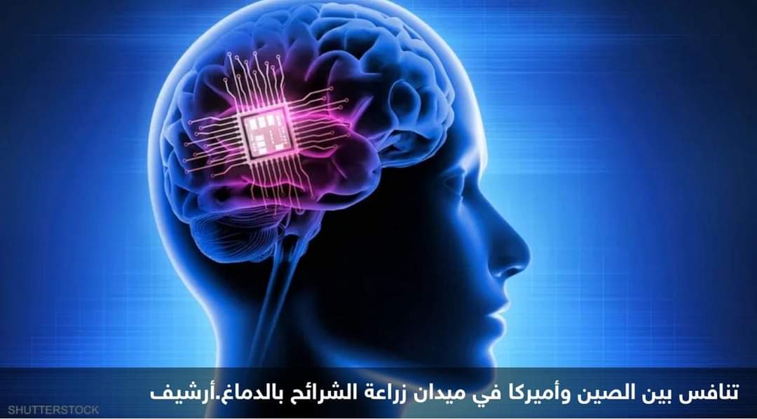 الصين تدخل ميدان “الشرائح الدماغية”.. وتنافس شركة إيلون ماسك