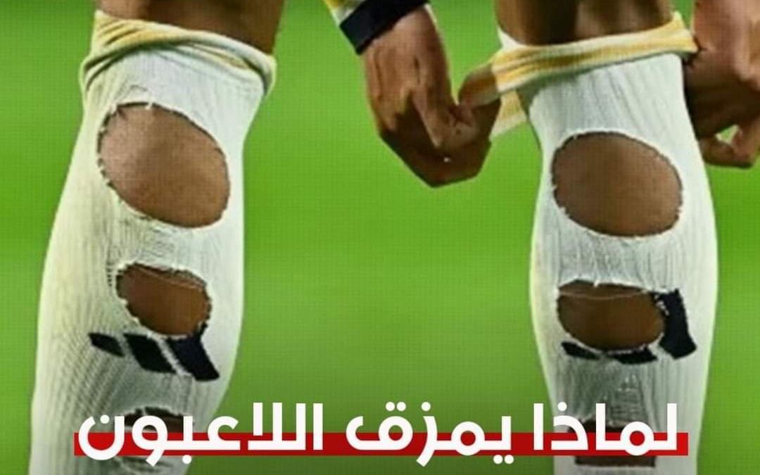 لماذا يمزق اللاعبون جواربهم وما رأي قانون كرة القدم؟