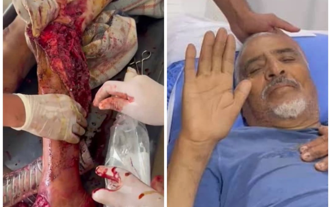 مدير مشروع طريق الفقيد الحيدري بيافع رصد يتعرض لاصابة بليغه اثناء العمل بالمشروع .