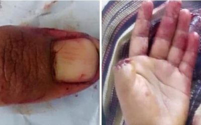 لحجي يبتر ابهامه لارساله للتوقيع على استلام راتبه