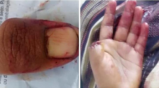 لحجي يبتر ابهامه لارساله للتوقيع على استلام راتبه