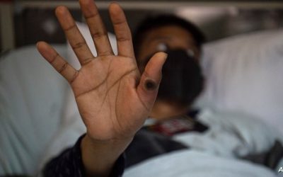 قادمون من دولة خليجية.. باكستان ترصد 3 إصابات بجدري القردة