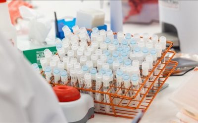دعوة أممية إلى تضامن عالمي لحماية نازحي إفريقيا من جدري القردة