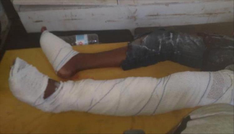 إصابة طفل بجروح بالغة إثر انفجار لغم حوثي غرب حيس