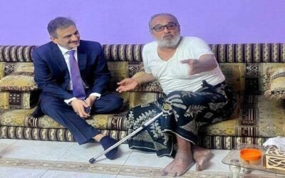 لملس يزور الفنان قاسم عمر ويوجّه بتحمل تكاليف علاجه