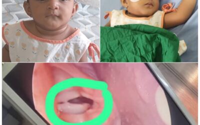 جديد الطفلة رهف والحالة المرضية الأخرى