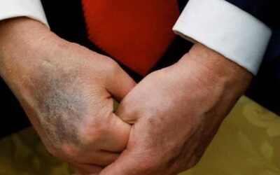 ترامب يكسر صمته بعد إنتشارشائعة وفاته