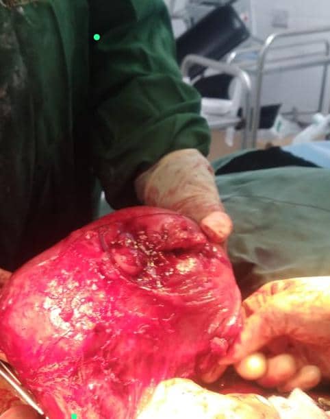 الإستشارية د.عبيرالعابد..الكفاءة والإنسانية ينقذان حياة جنين وأمه بعملية نوعية  في هيئة مستشفى الرازي العام بأبين* ..