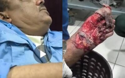 إصابة رجل مرور  بحادث دهس في عتق ومناشدات للتدخل  العاجل