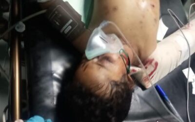 عاجل | فاجعة إنسانية مروعة تهز الضالع
