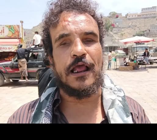 مناشدة لإدراج المناضل المكفوف صالح المقفعي ضمن مشروع العرس الجماعي